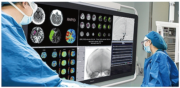 脳画像解析プログラムを四国初導入
